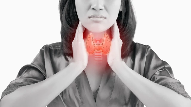 Viêm tuyến giáp mãn tính và những thay đổi thường gặp của cơ thể