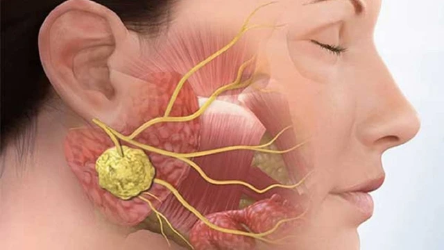 bai-viet/viem-tuyen-nuoc-bot-co-lay-khong-bien-chung-va-cach-dieu-tri.html