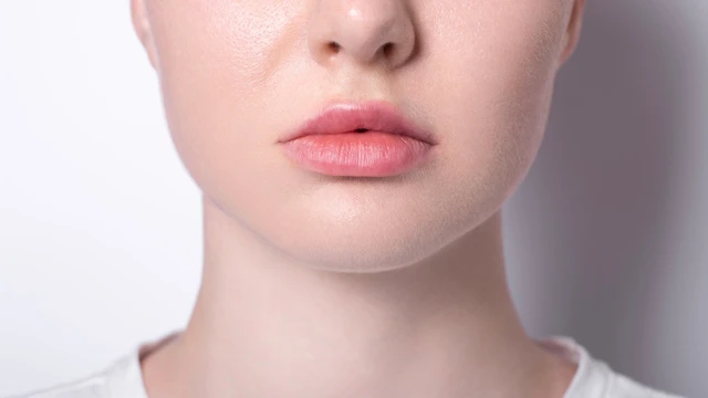 bai-viet/vien-moi-bi-lech-la-gi-nguyen-nhan-va-bien-phap-khac-phuc-hieu-qua.html