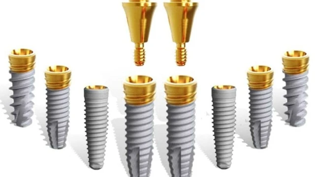 bai-viet/tru-implant-nobel-biocare-la-gi-co-an-toan-khong.html