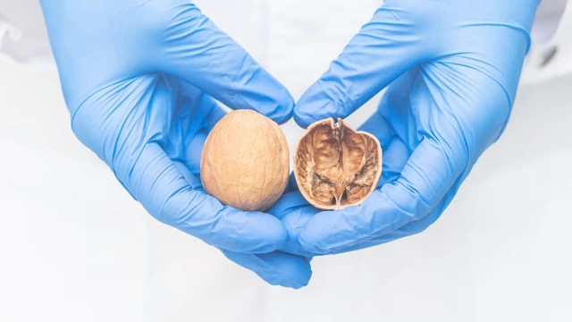 bai-viet/voi-hoa-tinh-hoan-la-gi-nguyen-nhan-trieu-chung-cach-dieu-tri.html