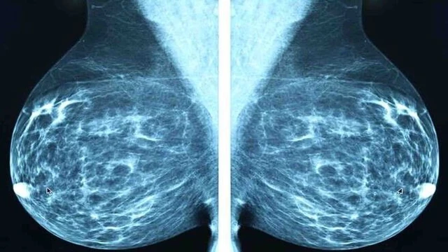 bai-viet/voi-hoa-tuyen-vu-nguyen-nhan-la-do-dau.html