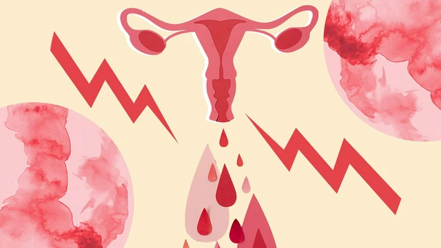 bai-viet/vung-kin-noi-man-do-khi-co-kinh-nguyet-la-bi-benh-gi.html