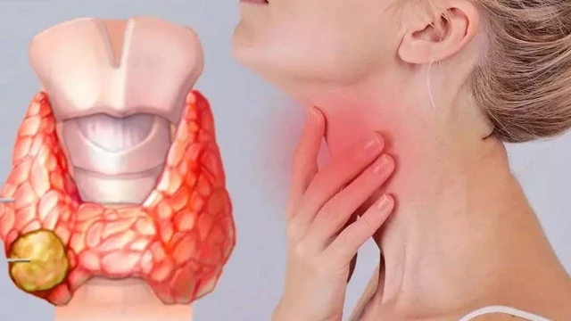 bai-viet/xa-tri-ung-thu-tuyen-giap-phuong-phap-dieu-tri-hieu-qua-va-nhung-dieu-can-biet.html