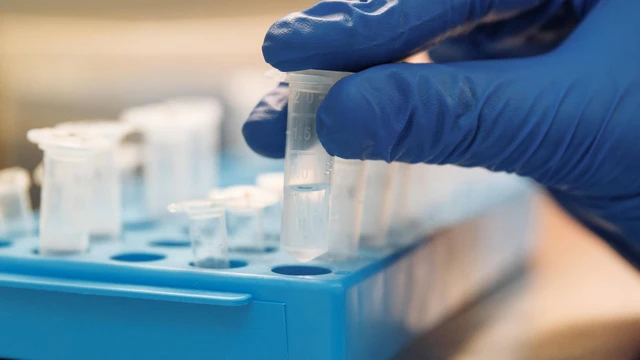 bai-viet/xet-nghiem-adn-me-con-khi-nao-thuc-hien-va-nhung-dieu-can-biet.html