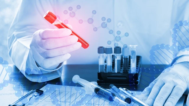 bai-viet/xet-nghiem-ana-la-gi-khi-nao-can-thuc-hien.html