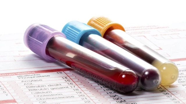 bai-viet/xet-nghiem-bach-cau-trong-chan-doan-benh.html