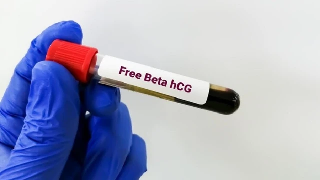 bai-viet/xet-nghiem-beta-h-cg-la-gi-ket-qua-xet-nghiem-beta-hcg-co-y-nghia-gi.html