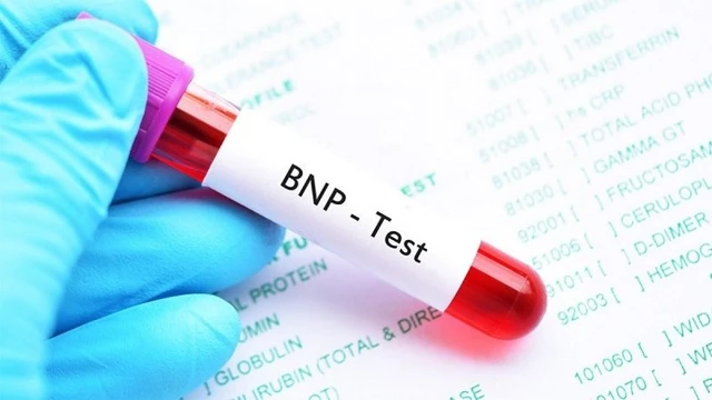 bai-viet/xet-nghiem-bnp-la-gi-y-nghia-cua-ket-qua-xet-nghiem-bnp.html