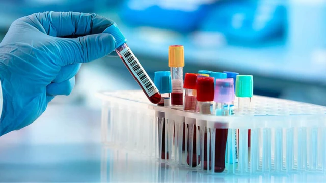 bai-viet/xet-nghiem-calci-ion-hoa-la-gi-tam-quan-trong-cua-xet-nghiem-calci-trong-mau.html