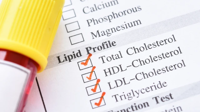 bai-viet/xet-nghiem-cholesterol-la-gi-truong-hop-nao-nen-xet-nghiem-cholesterol.html