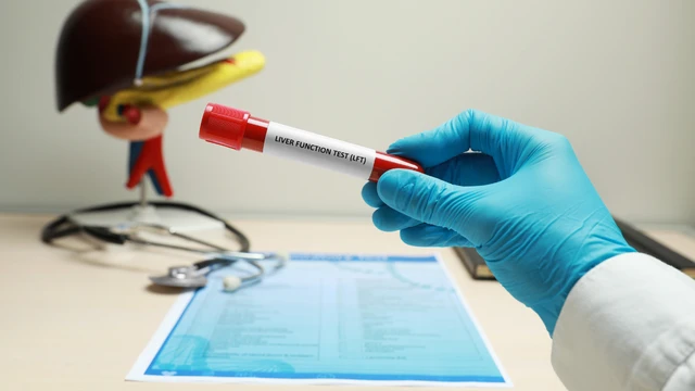 Xét nghiệm chức năng gan là gì? Các xét nghiệm thường gặp