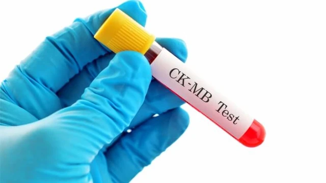 bai-viet/xet-nghiem-ck-la-gi-khi-nao-can-lam-xet-nghiem-ck.html