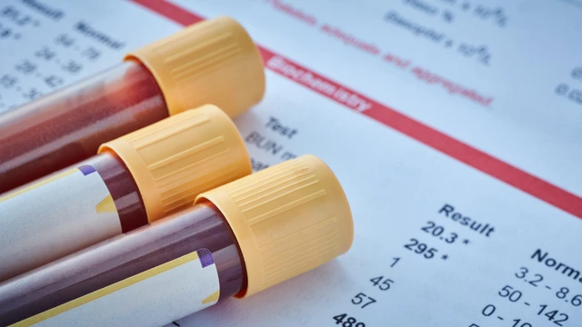 bai-viet/xet-nghiem-cong-thuc-mau-la-gi-thong-tin-ve-cac-chi-so-suc-khoe-quan-trong.html