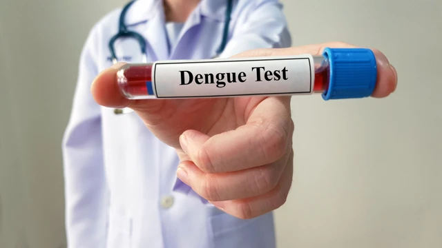 bai-viet/xet-nghiem-dengue-ns-1-ag-o-dau-uy-tin-va-chinh-xac-nhat.html