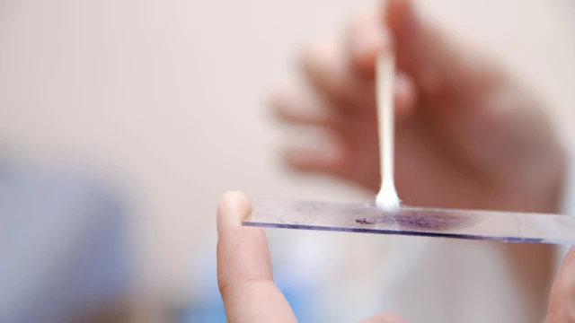 bai-viet/xet-nghiem-giang-mai-va-nhung-dieu-can-biet.html