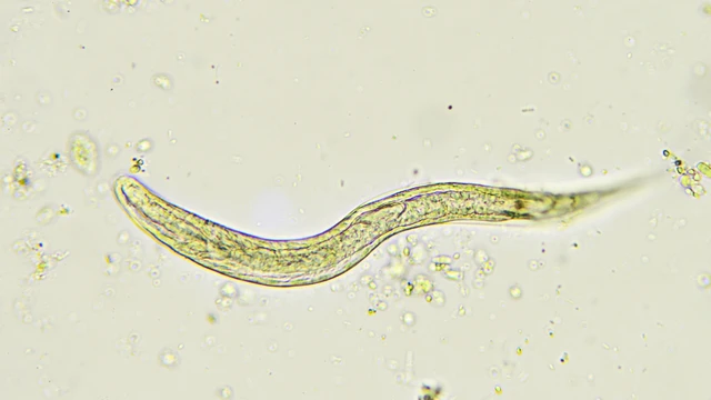 bai-viet/xet-nghiem-giun-san-gia-bao-nhieu-cac-loai-xet-nghiem-giun-san.html