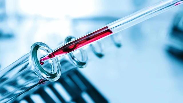 bai-viet/xet-nghiem-h-pylori-ig-g-cho-ket-qua-duong-tinh-co-y-nghia-gi.html