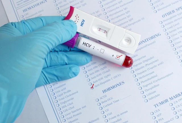 bai-viet/xet-nghiem-hbsab-co-y-nghia-gi-trong-viec-phong-chong-viem-gan-b-49088.html