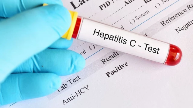 bai-viet/xet-nghiem-hcv-ab-la-gi-vai-tro-cua-hcv-ab-trong-chan-doan-benh-viem-gan.html