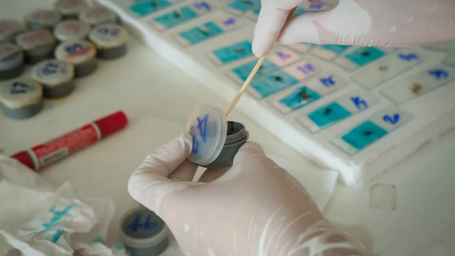 bai-viet/xet-nghiem-ky-sinh-trung-o-dau-ha-noi-nhung-luu-y-can-biet.html