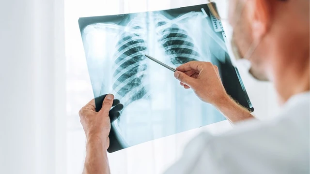 bai-viet/xet-nghiem-lao-phoi-bao-lau-co-ket-qua-phu-thuoc-yeu-to-nao.html