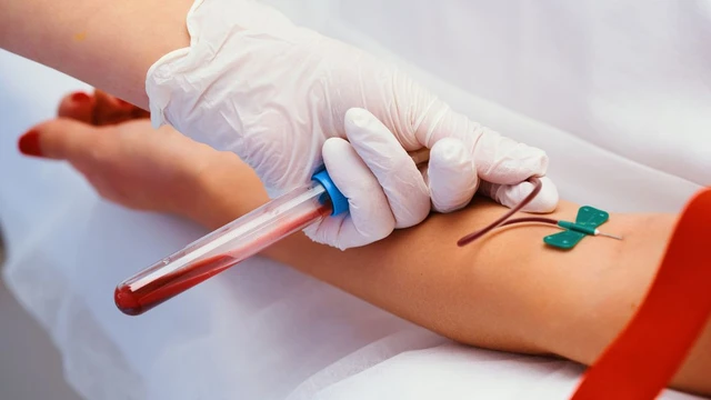 bai-viet/xet-nghiem-mau-co-can-nhin-an-khong-khi-nao-co-va-khi-nao-khong.html