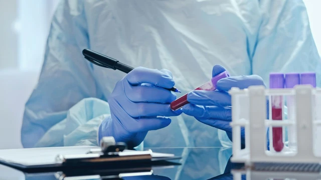 bai-viet/xet-nghiem-mau-co-phat-hien-ung-thu-khong-giup-phat-hien-loai-ung-thu-nao.html