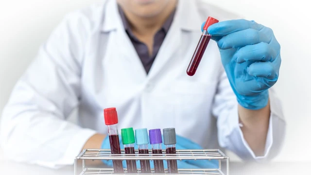 bai-viet/xet-nghiem-mau-va-nhung-thong-tin-co-the-ban-chua-biet.html