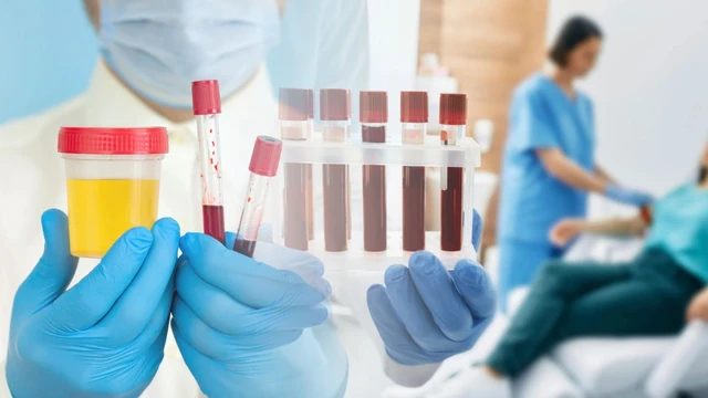 bai-viet/xet-nghiem-mau-va-nuoc-tieu-thong-tin-quan-trong-ban-can-biet.html