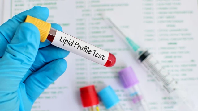 bai-viet/nen-xet-nghiem-mo-mau-bao-lau-1-lan-loi-khuyen-cho-tung-doi-tuong.html