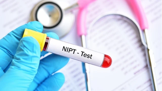 bai-viet/xet-nghiem-nipt-la-gi-nhung-dieu-can-biet-ve-xet-nghiem-nipt-60340.html