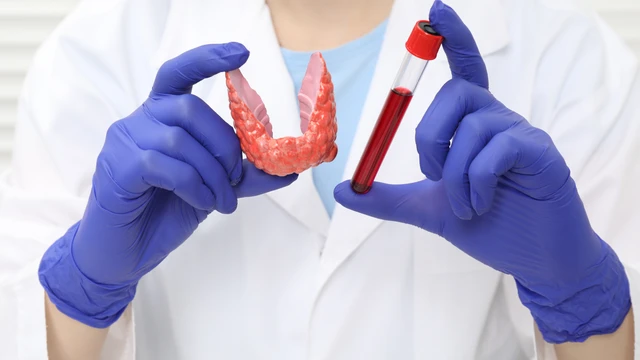 bai-viet/xet-va-nghiem-suy-giap-vai-tro-quan-trong-trong-chan-doan-va-theo-doi-benh-ly-tuyen-giap.html