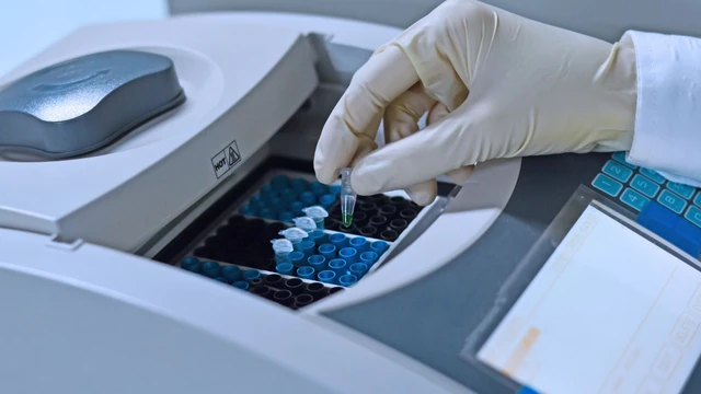 Xét nghiệm tay chân miệng: Thông tin quan trọng cha mẹ cần biết