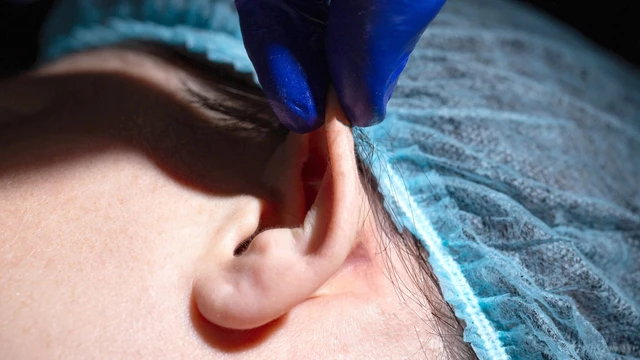 bai-viet/xet-nghiem-thoi-gian-mau-chay-vai-tro-va-doi-tuong-can-thuc-hien.html