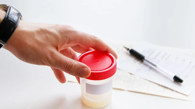 bai-viet/xet-nghiem-tinh-dich-do-bao-nhieu-tien-bao-lau-co-ket-qua.html