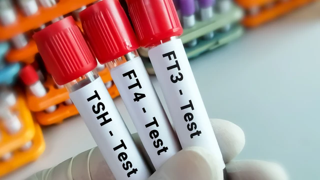 bai-viet/xet-nghiem-tuyen-giap-bao-nhieu-tien-khi-nao-can-thuc-hien.html