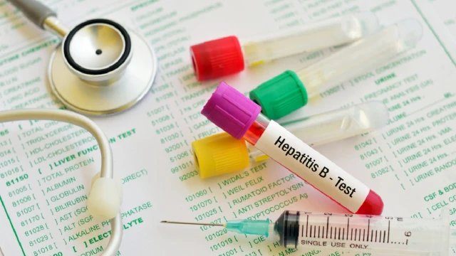 bai-viet/xet-nghiem-viem-gan-b-am-tinh-va-nhung-dieu-can-biet.html