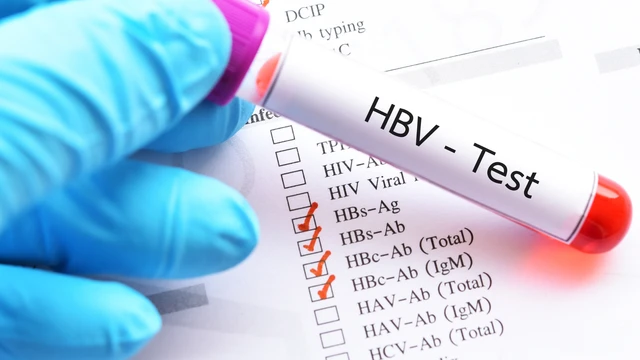 bai-viet/xet-nghiem-viem-gan-b-la-gi-cac-loai-gia-tien-va-noi-xet-nghiem-uy-tin.html