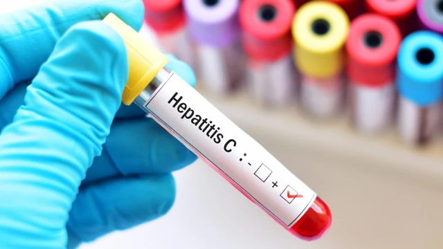 bai-viet/xet-nghiem-viem-gan-c-bao-nhieu-tien-nhung-thong-tin-ban-can-biet.html