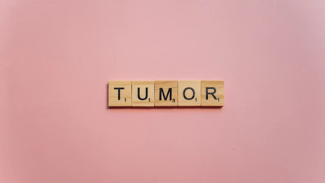 benh/xo-cung-cu.html