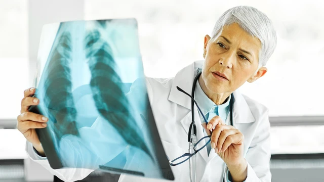 bai-viet/xo-phoi-co-chua-duoc-khong-cac-phuong-phap-dieu-tri-hien-nay.html