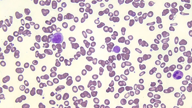 bai-viet/xo-tuy-xuong-nguyen-phat-la-gi-dau-hieu-nguyen-nhan-va-phuong-phap-dieu-tri.html