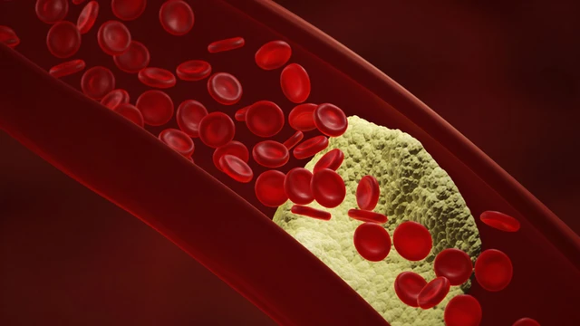 bai-viet/xo-vua-dong-mach-chu-bung-nguyen-nhan-trieu-chung-va-phuong-phap-dieu-tri.html