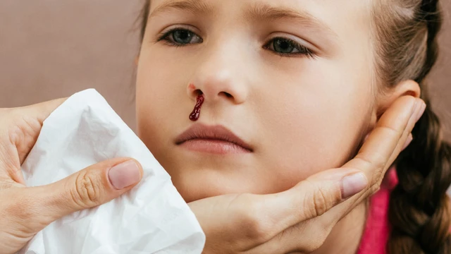 bai-viet/xuat-huyet-giam-tieu-cau-o-tre-em-nguyen-nhan-dau-hieu-cach-dieu-tri-va-mot-so-luu-y.html