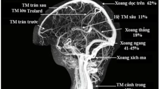 bai-viet/y-nghia-cua-chup-mra-cong-huong-tu-mach-mau-65455.html