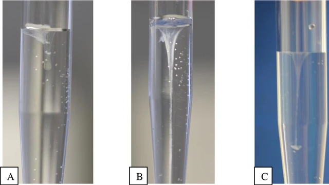 bai-viet/xet-nghiem-rivalta-la-gi-y-nghia-cua-xet-nghiem-rivalta-tren-lam-sang.html