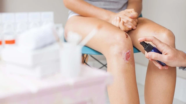 bai-viet/yeu-nao-dan-den-vet-thuong-lau-lanh-hon-binh-thuong-57928.html