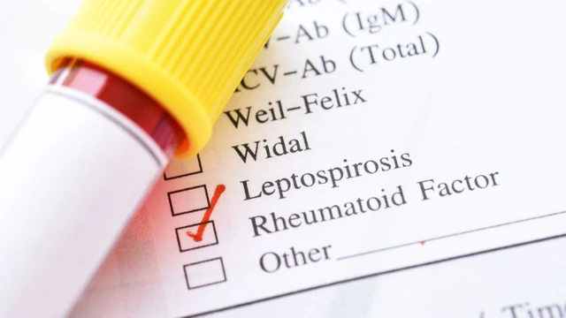 bai-viet/yeu-to-dang-thap-la-gi-y-nghia-xet-nghiem-yeu-to-dang-thap.html