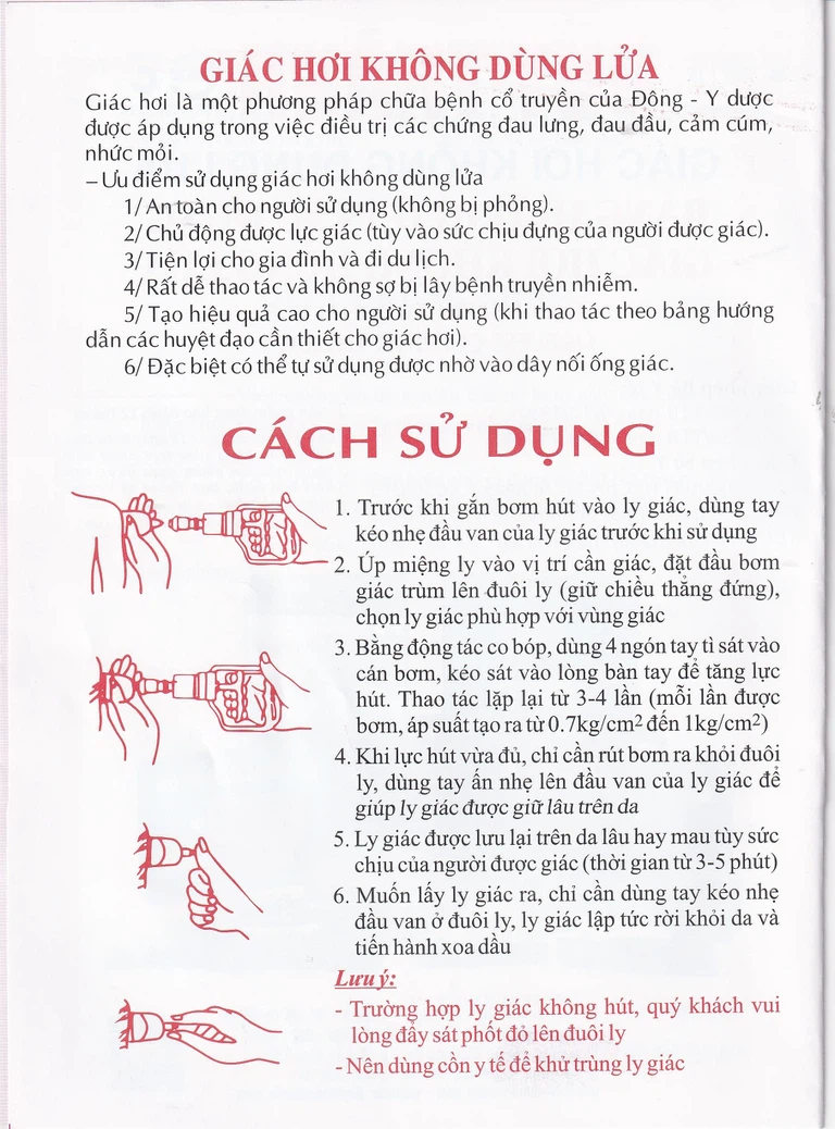 Bộ giác hơi không dùng lửa Duy Thành chữa trị các chứng đau lưng, đau ở vai